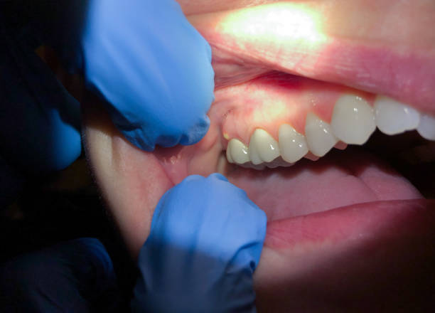 Best Emergency Treatment for Toothache in Seadrift, TX
