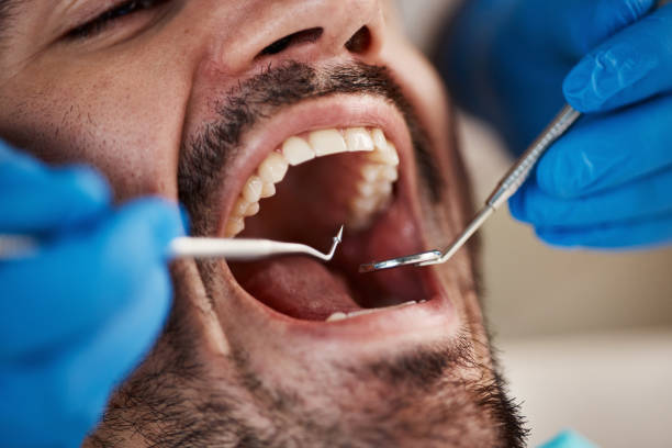 Best Emergency Treatment for Toothache in Seadrift, TX